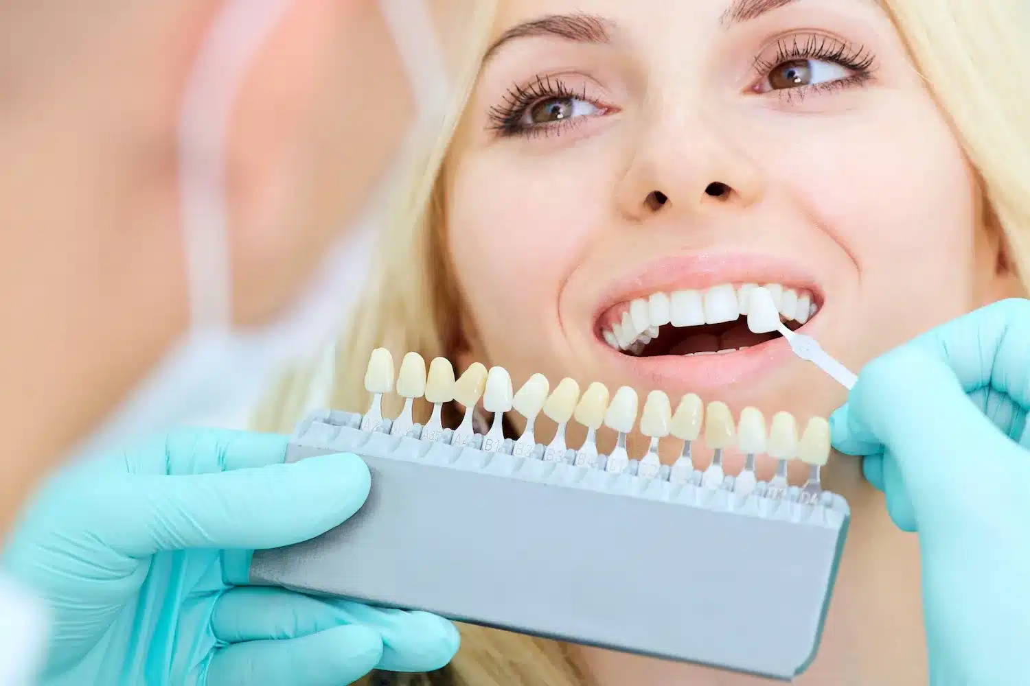Use Dental Veneers to Transform Your Smile in Time for Thanksgiving